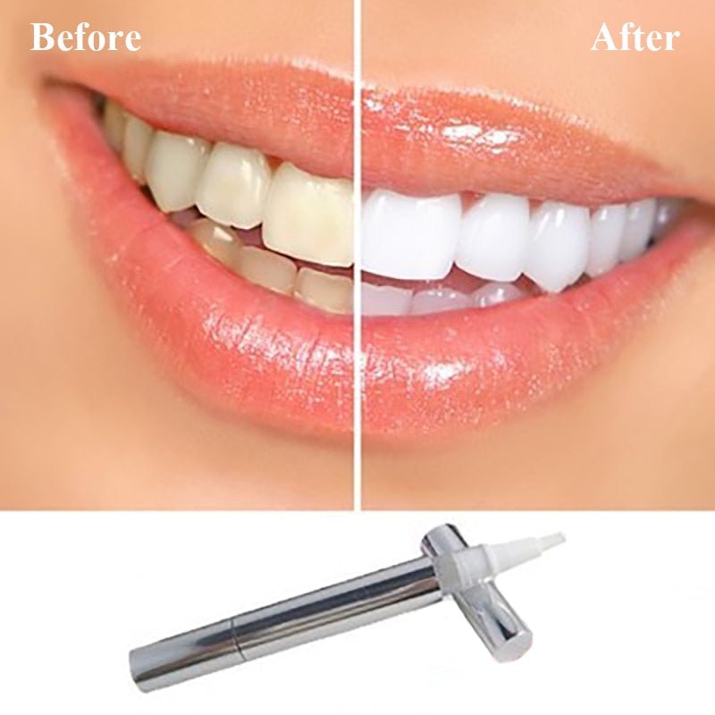 TeethWhiteningPen™ - Der schnellste Weg, Ihre Zähne aufzuhellen